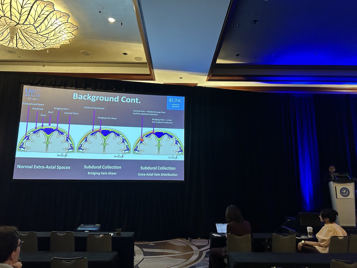 Dr. Baskar delivered an amazing presentation of our work! Wow! #SPR2024 ⁦<a href="/unc_neurorads/">UNC Neuroradiology</a>⁩ ⁦<a href="/UNCRadiology/">UNC Radiology</a>⁩ ⁦<a href="/uncchildrens/">UNC Children's</a>⁩ #pedineurorad
