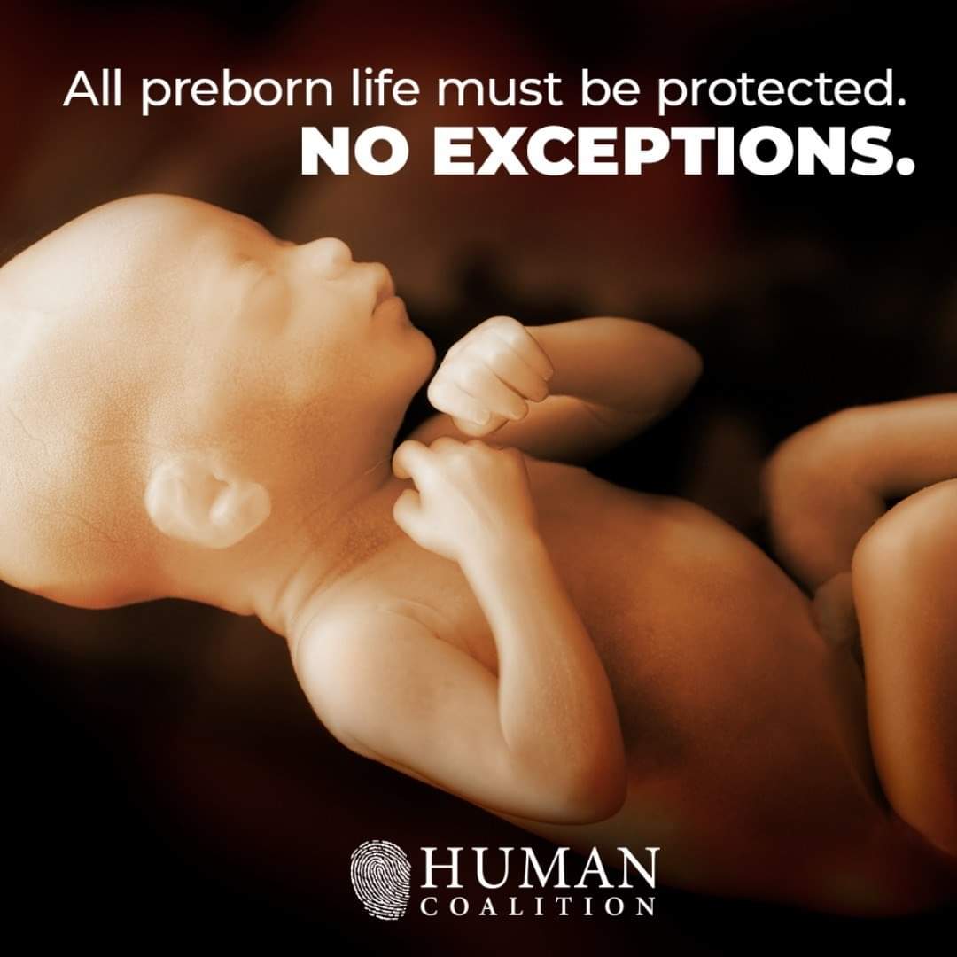 No abortions. No exceptions.