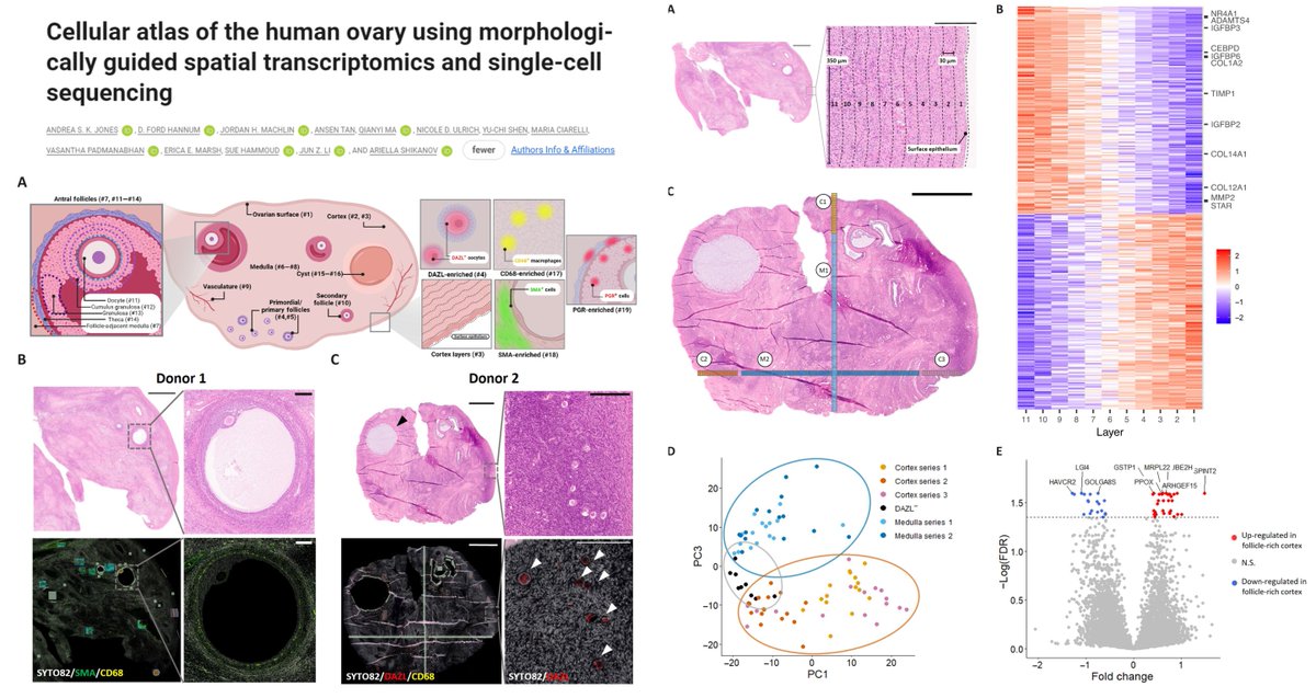 Molecular Anatomy of Human Ovary 18 y/o; 27 y/o A delicate histology-guided #SpatialTranscriptomics #GeoMx @nanostringtech Surface Cortex Medulla Cyst Vessel Follicles (primary/secondary/antral [oocyte granulosa theca follicle-adjacent medulla]) Love this paper; really great