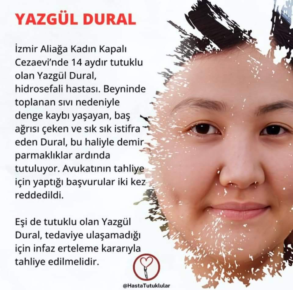 Yazgül Dural hidrosefali hastası. Baş dönmesi, kusma ve denge kaybı sık yaşıyor. Savcı, oğluna: 'Üzülme en fazla 20 gün sonra annen eve gelir, gelmezse memlekette adalet bitmiştir.' demişti, annesi 17 aydır tutuklu. Bür ülkede AdaletOlmazsa ;