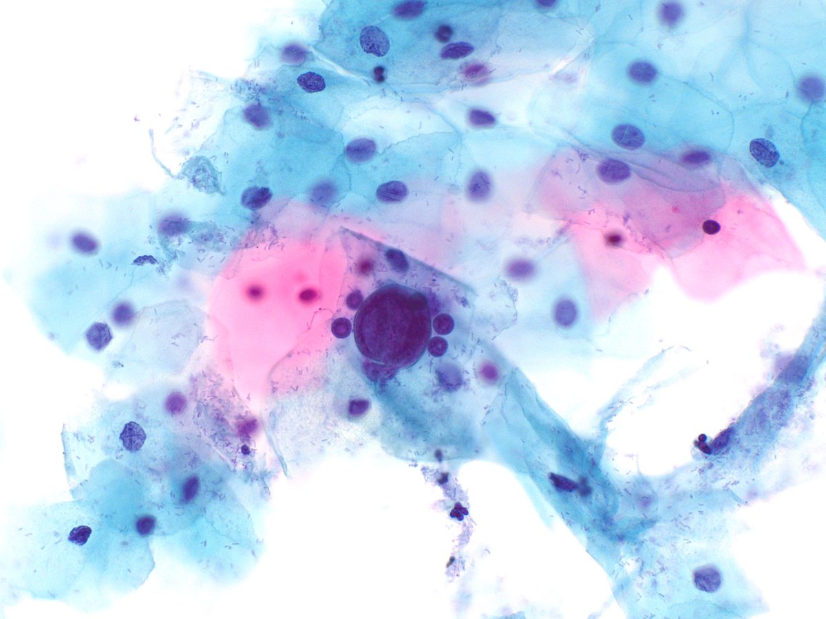 Jaylou M. Velez Torres, MD 🇵🇷🇺🇸 tweet media