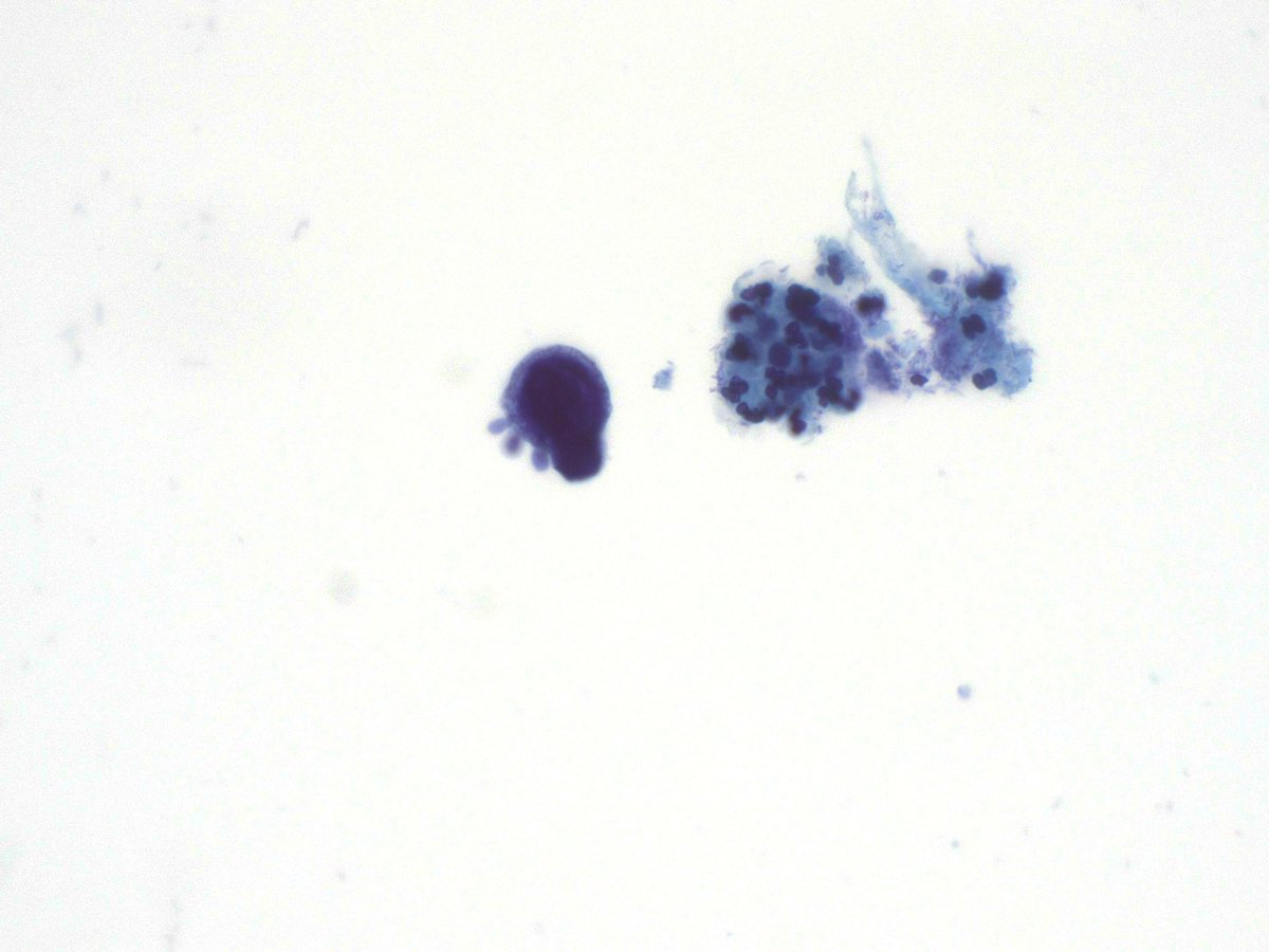 What do you think about this incidental finding in a Pap smear? @TotalCytopath @tlabiano @pepeheffernan