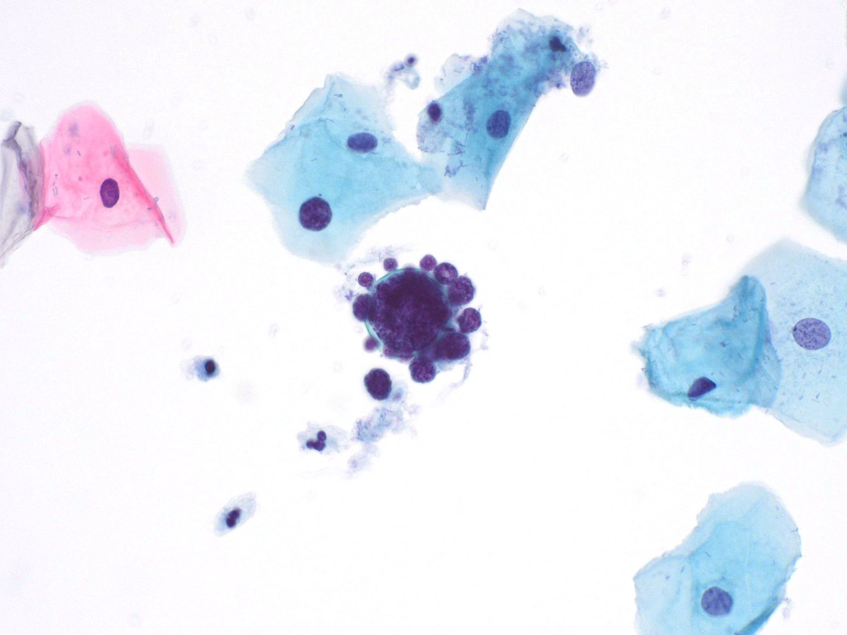 Jaylou M. Velez Torres, MD 🇵🇷🇺🇸 tweet media