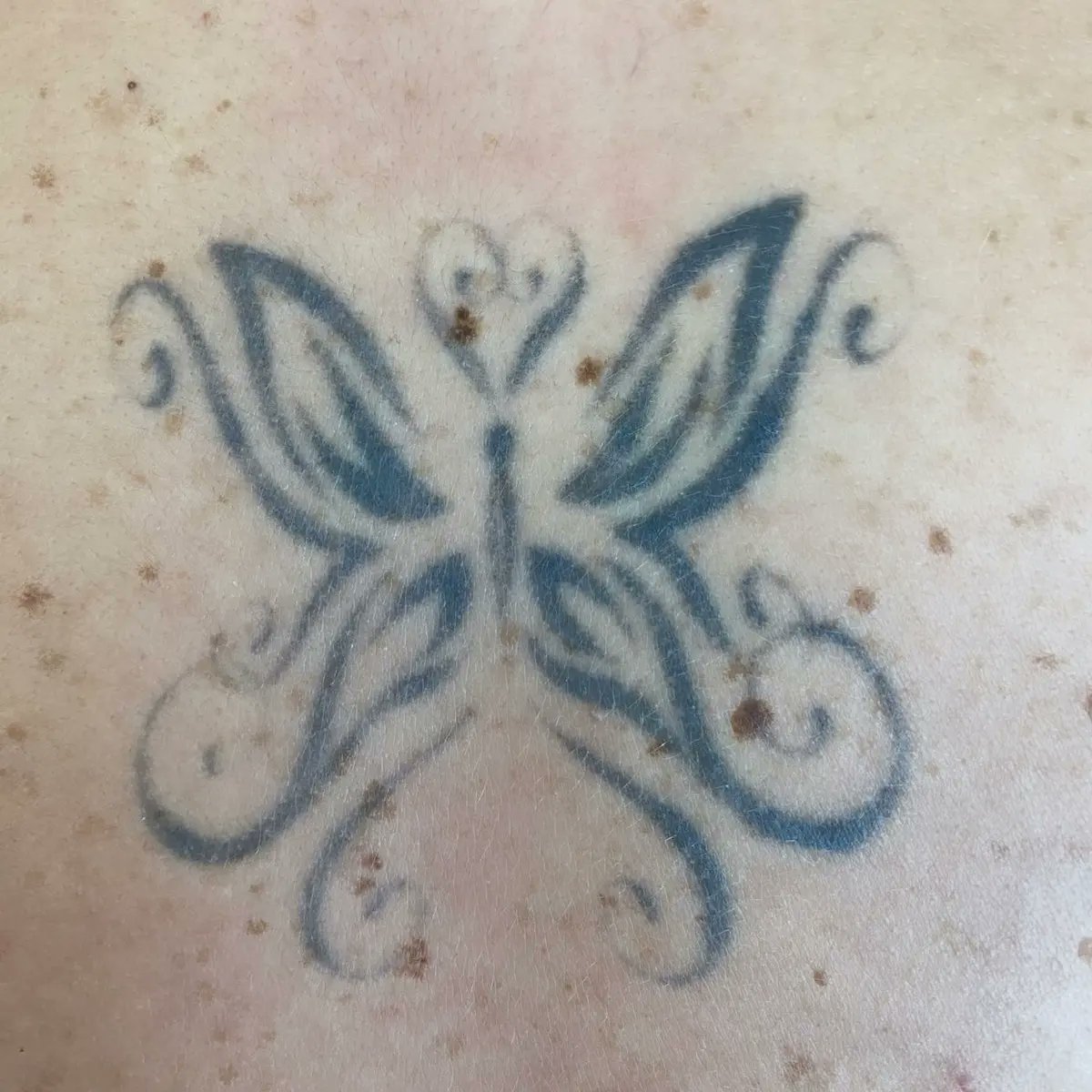 Leissues's tweet photo. Antes y Después #CoverUpTattoo 
IG: Leicohentattoo 
#tattoo #tattoos #tattoodesign #tattoolife #tatuagem #tattooing #tattooargentina #tattooworkers #tattooaddicts #tattooarg #tattoobuenosaires #tattoo_art_worldwide #tattoostudio #argentinatattoo #finelinetattoo https://t.co/y6EQSrT6dz