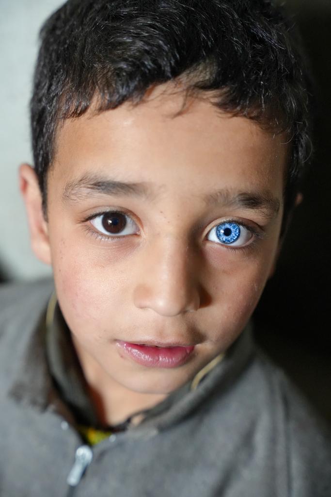 iamasoodifarhan's tweet photo. Faizan, a 7-year-old boy from Kupwara with heterochromia iridium, gained fame after appearing in a Vivo ad. However, some people have tried to exploit him. He is the only speaker in his family.

My latest work for @TheKashmiriyat 
https://t.co/dm9DdGvqD6 https://t.co/QezppzVick