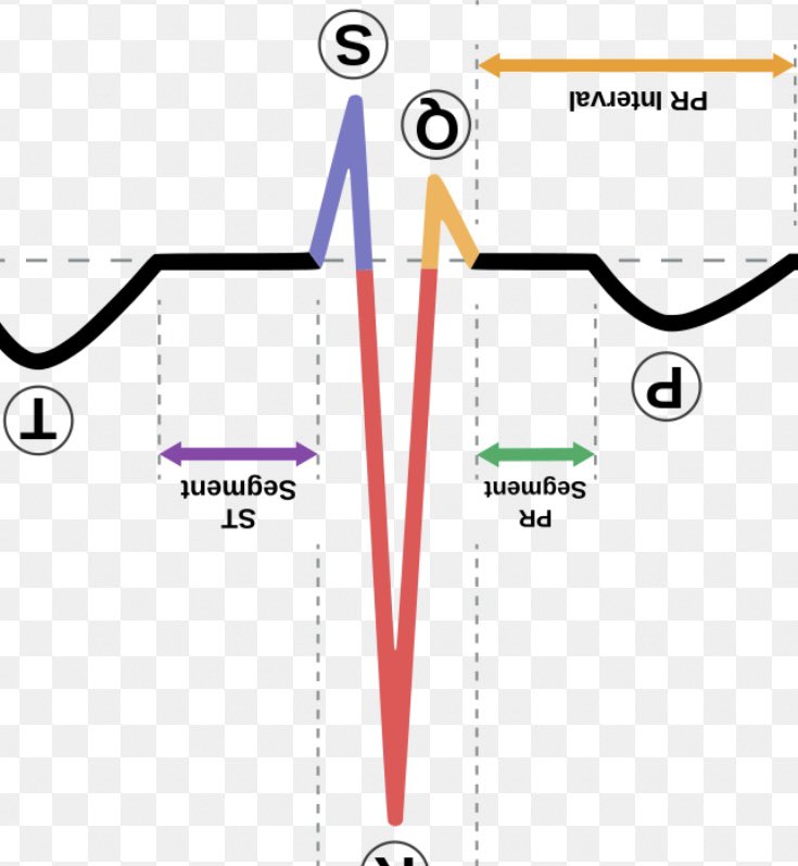 Carl Hellesen tweet media