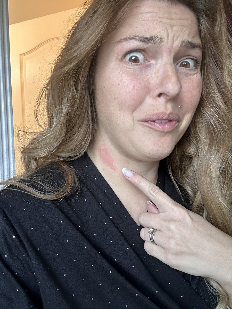 MrsLethal's tweet photo. Did I even curl my hair if I didn’t give myself the hockey burn? Like fuck. Every time. #makeuptime https://t.co/AcBW4a2wES