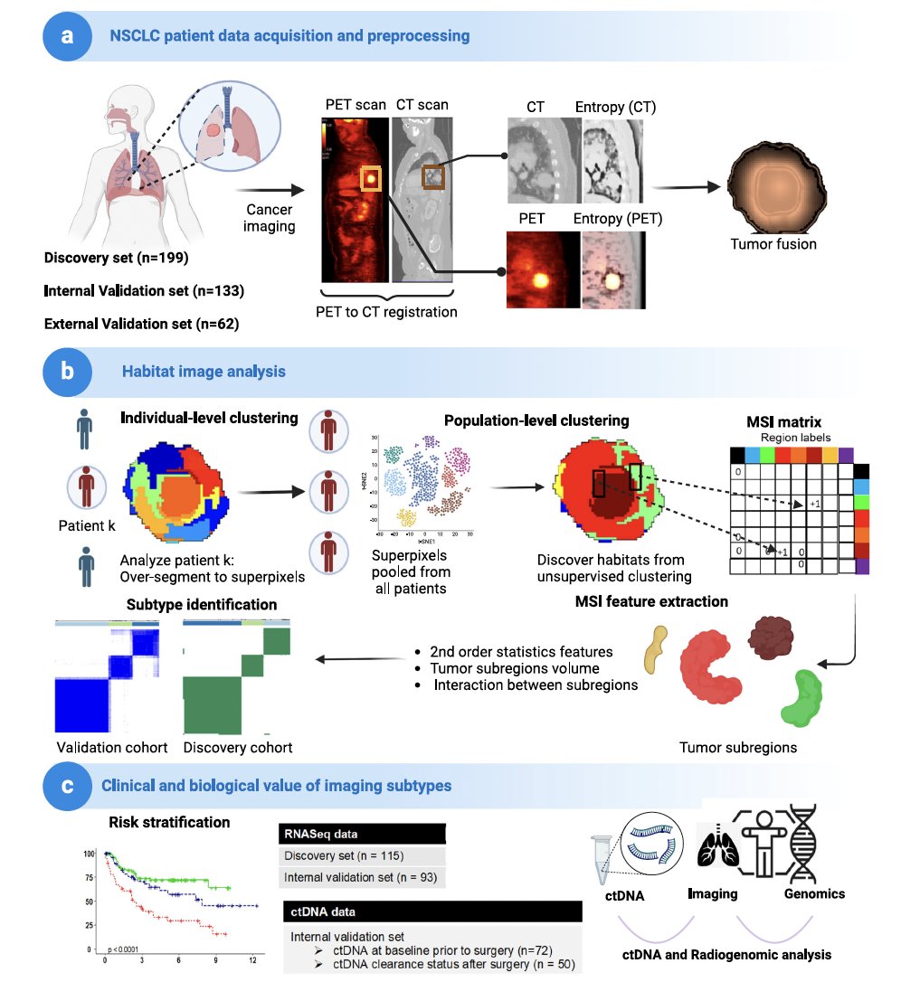 Xiuning Le MD PhD (@lexiuning) on Twitter photo <a href="/JiaWu_PhD/">Jia Wu</a> Now we can predict recurrence risk in resected lung cancer using habitat imaging and ctDNA integration model. The methodology can be applied to metastatic setting, and others. <a href="/MDAndersonNews/">MD Anderson Cancer Center</a> <a href="/LaurenByersMD/">Lauren Averett Byers, MD</a> @esinghimd
pubmed.ncbi.nlm.nih.gov/38605064/ <a href="/JiaWu_PhD/">Jia Wu</a> Now we can predict recurrence risk in resected lung cancer using habitat imaging and ctDNA integration model. The methodology can be applied to metastatic setting, and others. <a href="/MDAndersonNews/">MD Anderson Cancer Center</a> <a href="/LaurenByersMD/">Lauren Averett Byers, MD</a> @esinghimd
pubmed.ncbi.nlm.nih.gov/38605064/