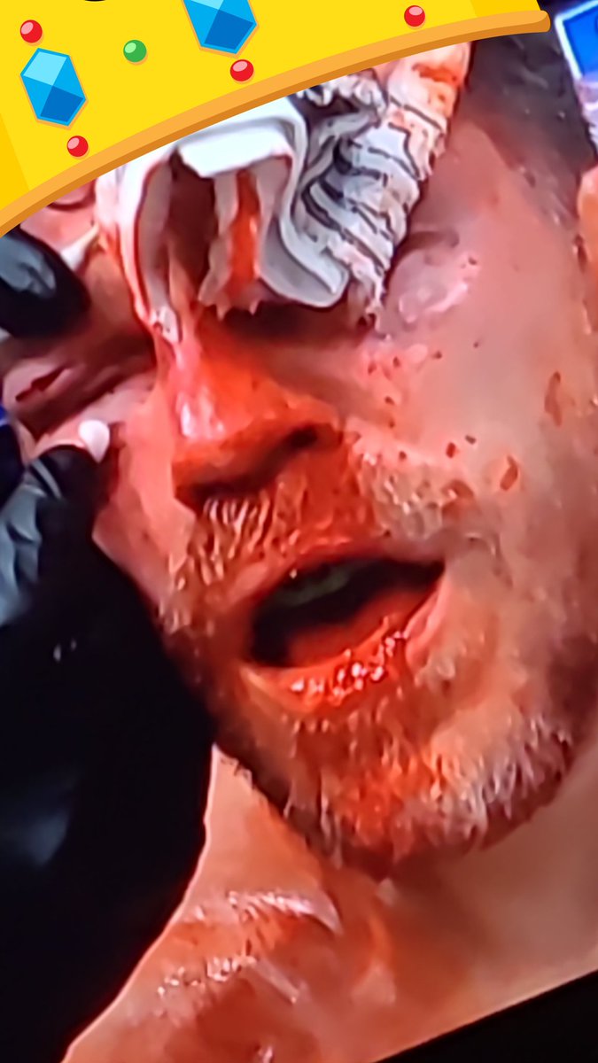 FPL__Cal's tweet photo. We love you Jim Miller this is hard to watch #UFC300 https://t.co/eP8kVM2KSs