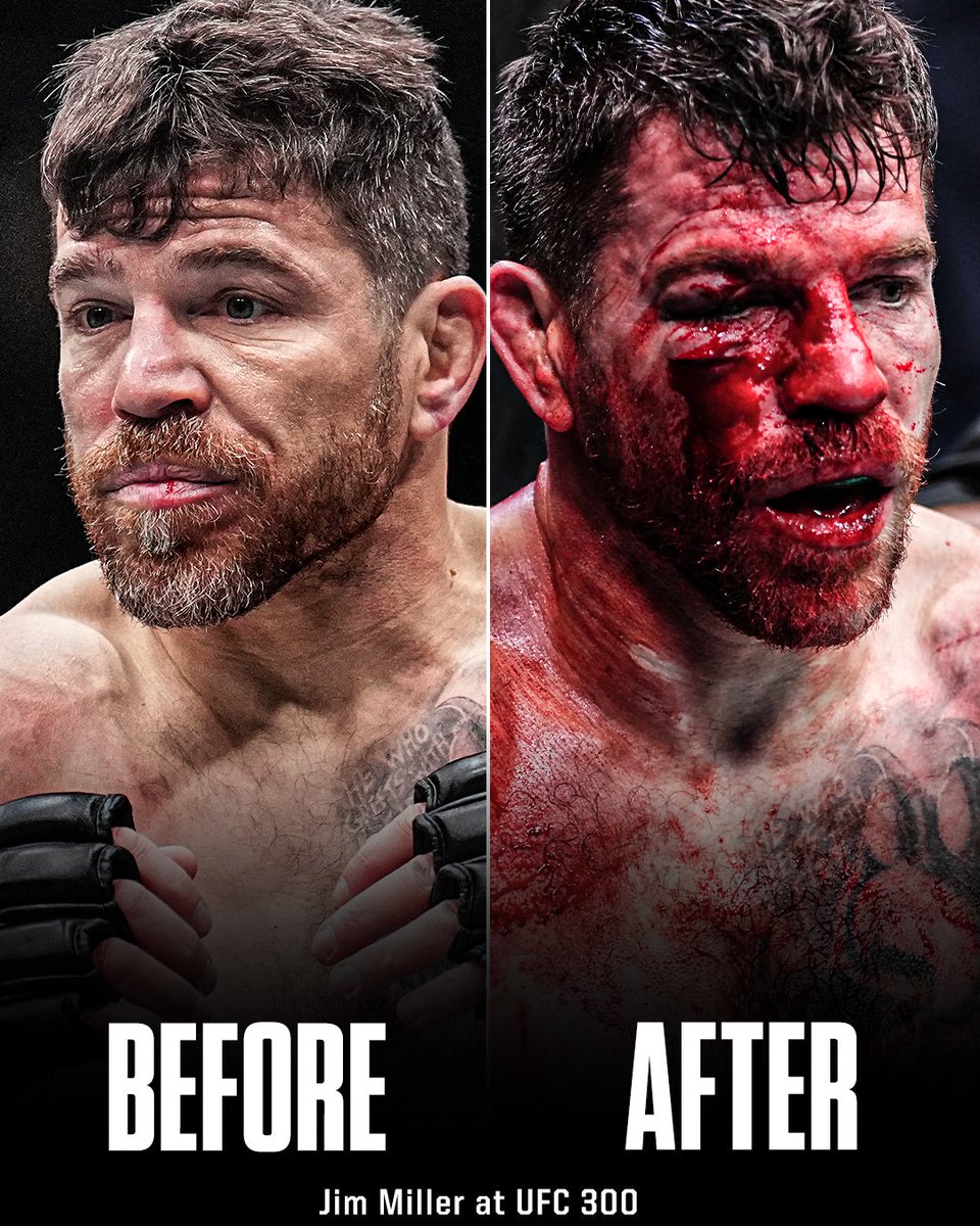 SportsCenter's tweet photo. Jim Miller is a warrior 🤕 #UFC300 https://t.co/tHpc5DnR6o