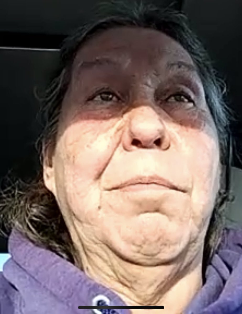 I just did a video chat with a new homeless friend from Wisconsin. She’s interested in telling her story on our Displaced live stream. She says police in Wisconsin just push people from city to city .