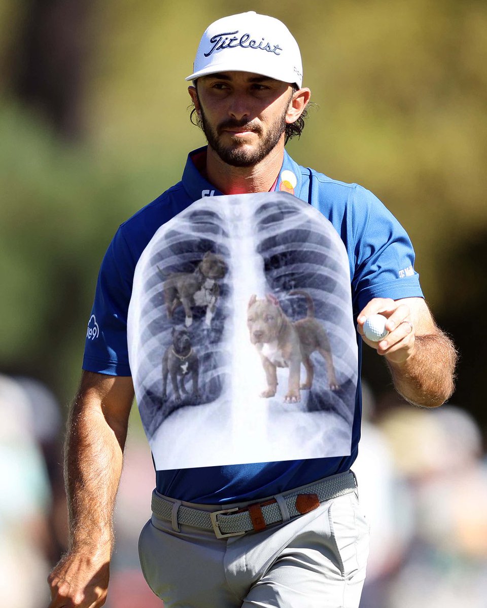 New X-Ray’s of Max Homa have just surfaced: