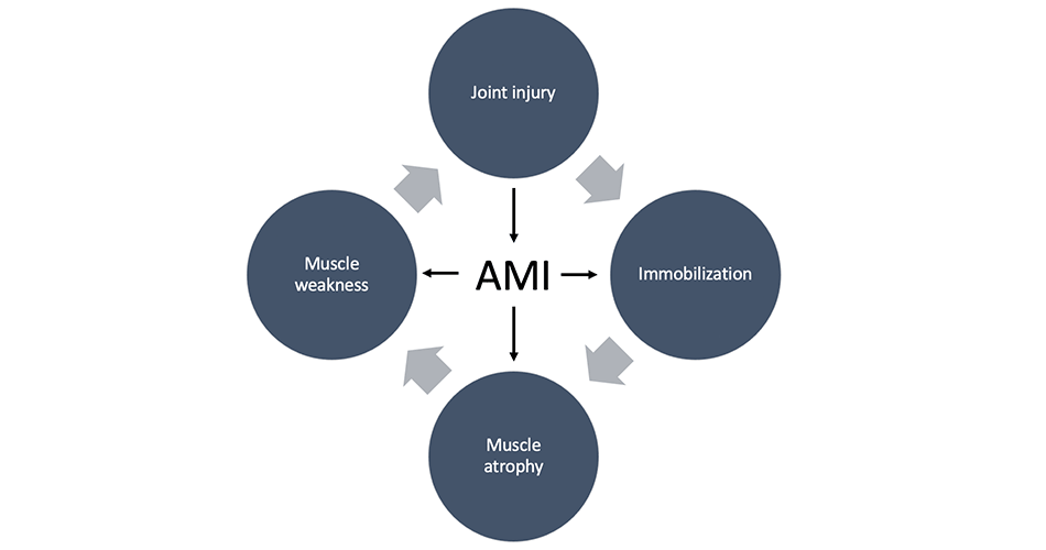 In this article, I share my challenging road to recovery, from a severe motorcycle accident to the decision to undergo surgery. This post is a perfect read for those facing similar challenges or interested in sports medicine and rehab 👉tinyurl.com/2tscuhsk #ACLR #Rehab