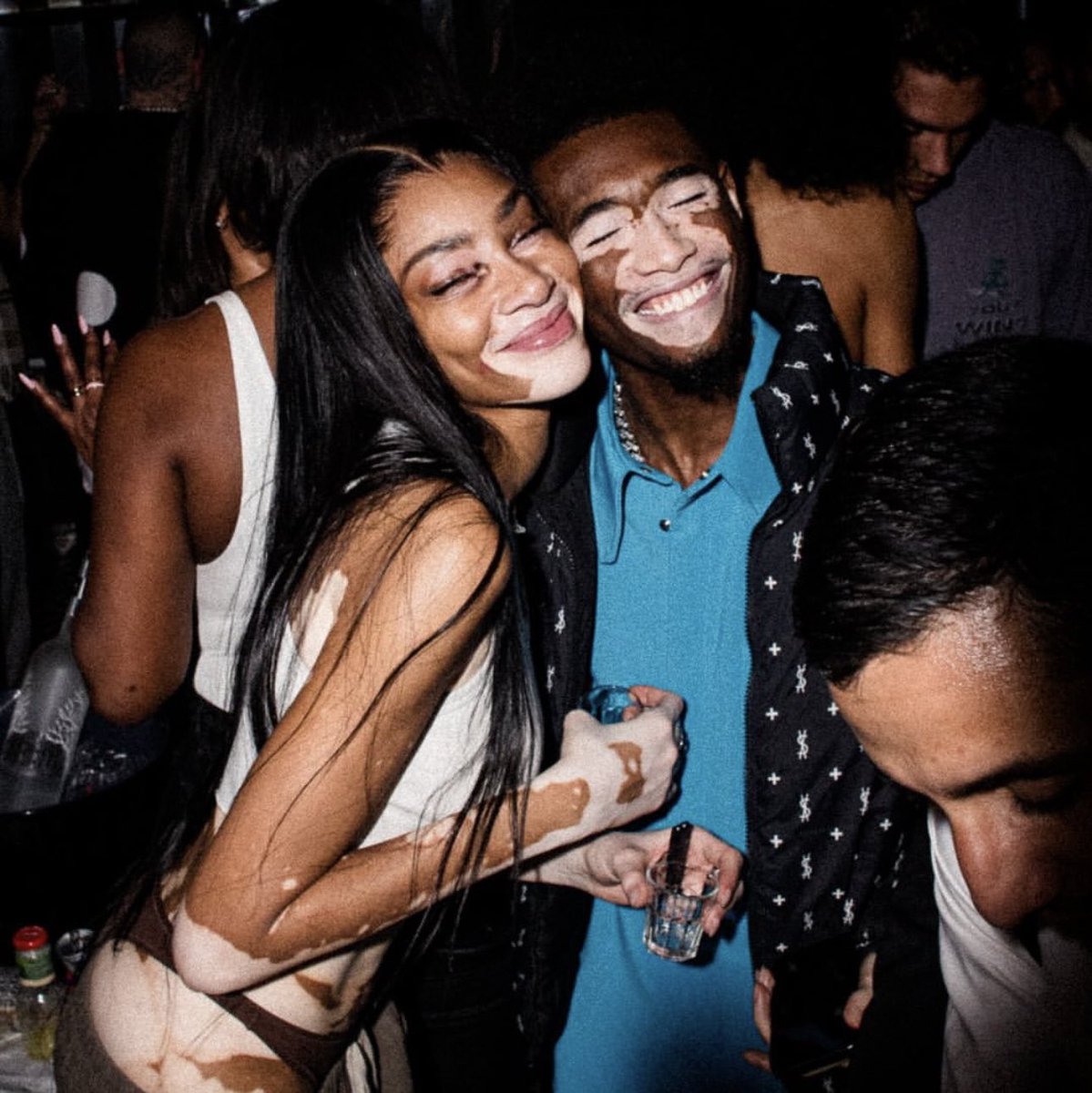 winnieharlow's tweet photo. Obsessed 🤍🤎 #vitiligo https://t.co/vxqi6wjPgY