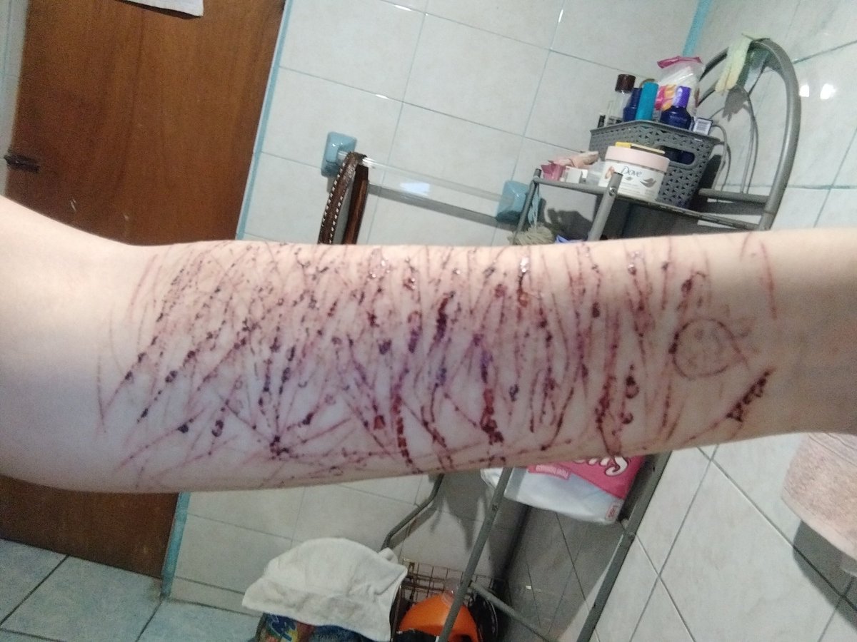 Samuelmatate's tweet photo. miren mi brazo!! (,,>﹏<,,)
(ignoren las cosas de atrás!!)

Busco mutiss ૮ ˶´ ᵕˋ ˶ა
•Doy rt
•Doy me gusta a las publicaciones!!

Estoy solito, necesito amigos (╥﹏╥)

#shtwt #cortadas #shtwt https://t.co/bel8gH7wAU