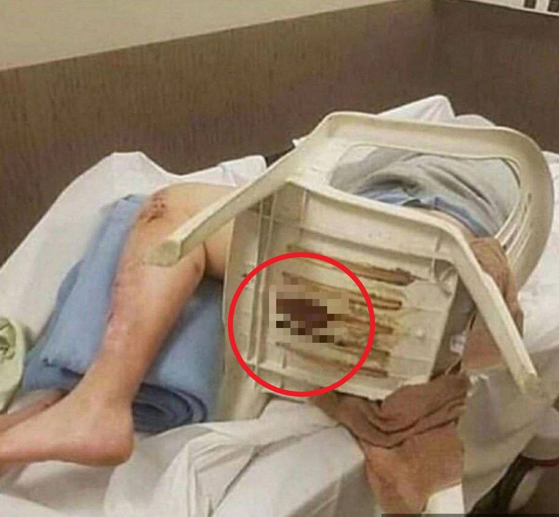 Dreamer2909's tweet photo. CONTENT WARNING‼️🤣🤣🤣 #Ivanovka #Russia. Denazification by plastic chair 🪑🪑🪑✂️✂️✂️🥚🥚‼️ #RussiaIsCollapsing #RussiaIsANaziState #RussiaIsATerroristState #PutinWarCriminal #PutinHitler #PutinNazi #PutinIsAKiller https://t.co/0pytILiSw3