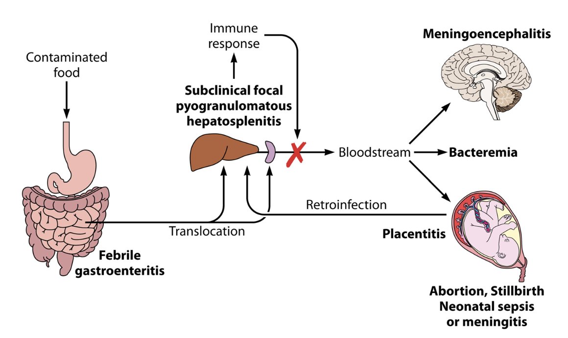 【Pathophysiology of listeriosis】Clin Microbiol Rev. 2023 Mar

👉Simple but always important Figure!

✍️1 take-home point
In those unable to mount an effective T-cell response, Listeria can enter the bloodstream!

#IDMedEd #IMResident #IDFellow

doi.org/10.1128/cmr.00…