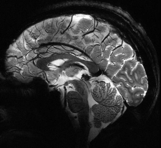 CeoImed's tweet photo. 美しい！
 
｢11.7テスラのMRIによる脳画像！｣
 
･ フランスのMRI
･ 現在、病院では磁場の大きさとして3T MRIが最高（画質もベスト）
･ 11.7Tは世界最高の磁場
･ 4分で撮像
･ 解像度は 0.2 mm
  
https://t.co/8uUPPAkwEo https://t.co/3aAIF3WJLM