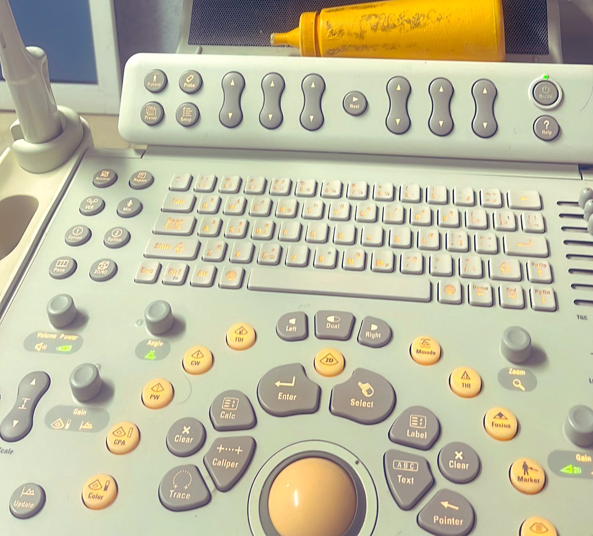 EmergPOCUS's tweet photo. ⌨️ #Knobología básica del Ultrasonido 🎚️

- Ganancia (#Gain): Aumenta o disminuye el valor blanco de la imagen. ⬆️⬇️
- Profundidad (#Depth): Cambia la profundidad de la imagen, con marcas de 1 cm al lado de la pantalla del monitor. 📏🔢
- #iScan: Optimiza automáticamente la ganancia y profundidad (el nombre puede variar entre sistemas). 🔄👨‍💻
- Congelar (#Freeze): Detiene (congela) la imagen del ultrasonido. ❄️🛑
- #Caliper: Se usa para medir distancias. 📐📏
- Imagen fija (Still image): A menudo etiquetado como guardar, almacena una foto fija de la imagen. 🖼️💾
- #Clips: Almacena un video, que puede ser ajustado a 5 latidos 🫀 o entre 3-5 segundos. 🎥⏱️
- #Zoom: Acercamiento en un área específica de la imagen, se puede hacer en vivo o en una imagen fija. 🎯
- Desplazamiento (Cine #scroll): Cuando la máquina está en pausa, reproduce los últimos 5 segundos, ideal para revisar estructuras específicas lentamente para mediciones. 🎞️🐌

🫡 Esto es solo lo básico; hay más botones por aprender, pero para empezar, estos son los botones esenciales 🌟. Cada máquina puede ser diferente; algunos botones vienen en español 🇪🇸, inglés 🇬🇧, ¡o incluso en ruso, lo juro! 🇷🇺✋. Además, algunas ya incluyen pantalla táctil 🖥️👆. Pero en general, esto debería ser un buen punto de partida 🚀. ¡Espero les sea de ayuda, saludos mis panas! 🙌🤗