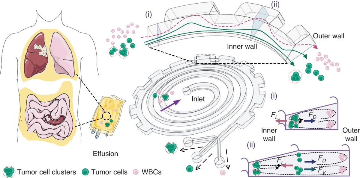 A team of researchers has unveiled a microfluidic device, designed to achieve the precise separation of tumor entities with unprecedented efficiency. These findings were detailed in an article published in Microsystems & Nanoengineering. #tumor
Details: 10.1038/s41378-024-00661-0