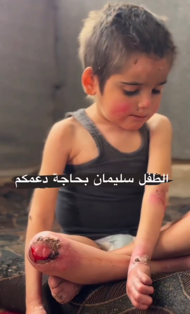 LOOK AT WHAT ISRAEL DID TO THIS CHILD