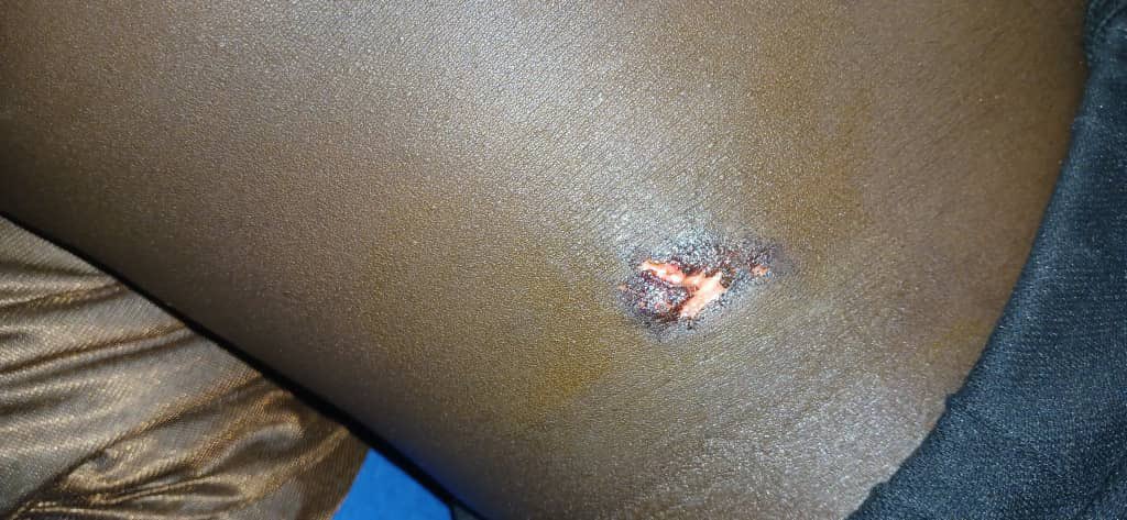 Zinasuzim's tweet image. 🚨ALERT: GZU STUDENTS TAKE TO THE STREETS

Yesterday, a student was assaulted, injured, &amp;amp; robbed on campus. Shockingly, the institution failed to provide security or arrange for an ambulance. Today, we demonstrate to demand answers. Student safety should be our priority! #Amandla