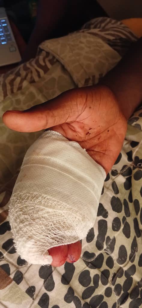 Zinasuzim's tweet image. 🚨ALERT: GZU STUDENTS TAKE TO THE STREETS

Yesterday, a student was assaulted, injured, &amp;amp; robbed on campus. Shockingly, the institution failed to provide security or arrange for an ambulance. Today, we demonstrate to demand answers. Student safety should be our priority! #Amandla