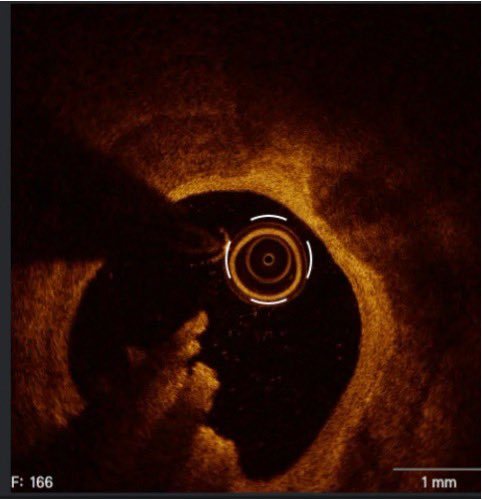 Jorge Padilla MD FACC tweet media