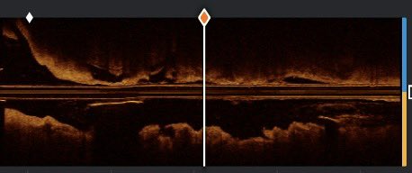 Jorge Padilla MD FACC tweet media