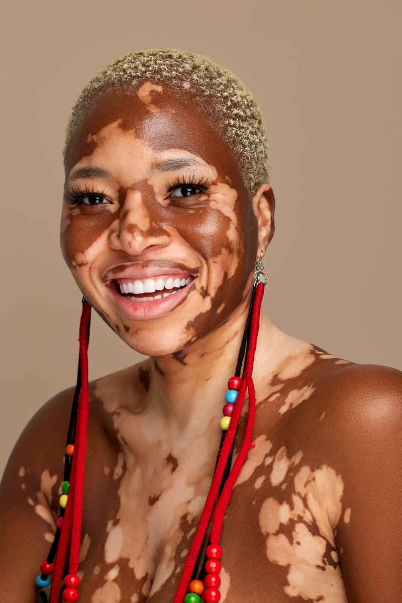 bentxilweddings's tweet photo. This portrait is a timeless reminder that true beauty knows no bounds https://t.co/C8U2vyBv9s