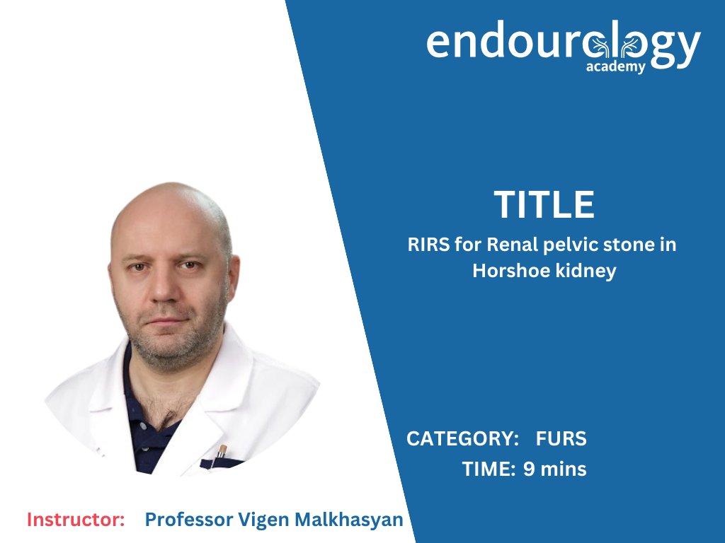 Prof @drvigen has uploaded an instructional video on RIRS for renal pelvic stone in horseshoe kidney Link to video: endourologyacademy.com/course-details…