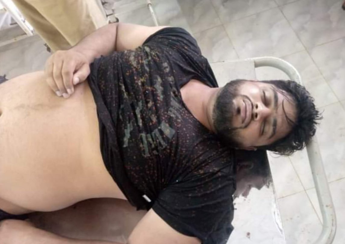 کراچی سے کينجھر جھیل آنے والا نوجوان پانی میں  ڈوب گیا جس کو کينجھر ٿانے کے پوليس اہلکاروں نے فوری ريسکيو سينٹر کينجھر پہنچایا جہاں اس کی موت ہو گئی 
ابھی تک نوجوان کی کوئی پہچان نہیں ہو سکی ہے
پوسٹ کو زیادہ  سے زیادہ شئیر کریں تا کہ نوجوان  کے رشتیداروں کو پتا چل سکے!!