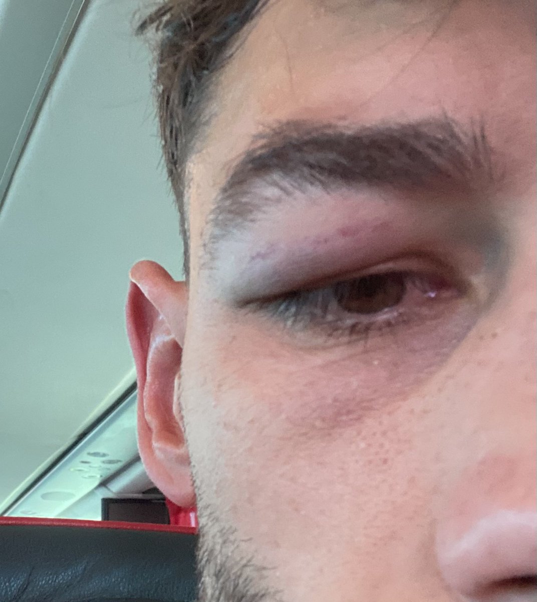 Quisiera agradecer al <a href="/AtcoSaguntino/">Atlético Saguntino ⚔️</a> y en especial a su cuerpo médico, por atenderme en el terreno de juego! (ya que no disponemos de servicio médico).
La afición sois espectaculares.
Bravo 👏🏾 y mil gracias!