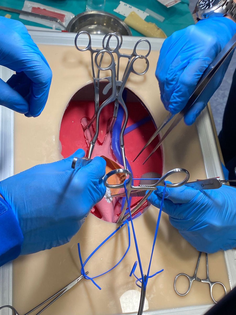 Exciting news! SimuVasc simulators played a role in the recent V360 simulation course at <a href="/vallhebron/">Vall d'Hebron</a>. Endovascular aortic aneurysm repair explant workshop. Thanks to <a href="/sbellmunt/">Sergi Bellmunt</a> y <a href="/SimulacioVH/">Vall d'Hebron Centre de Simulació Clínica Avançada</a> 
Join us on our journey through vascular surgery simulation. 
#simuvasc #valldhebron