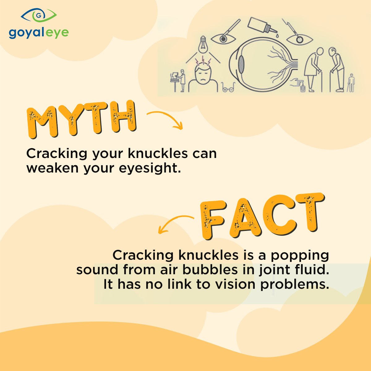 Do you fear that cracking your knuckles might harm your eyesight? 

Let's bust that myth! When you crack your knuckles, the sound is caused by the release of gas bubbles in the synovial fluid, which lubricates your joints.

#GoyalEye #EyeMythsAndFacts  #EyeMyths #EyeFacts