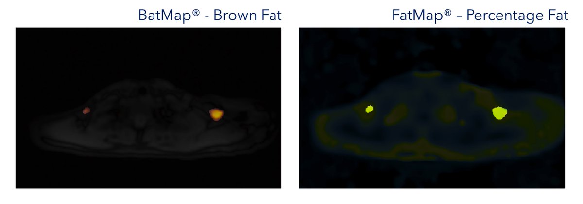 bodymapdigital's tweet photo. Threshold a #BatMap for the brown fat #BAT. #FatMap shows this is truly friendly #FAT (yellow). https://t.co/npYa0GrnsV