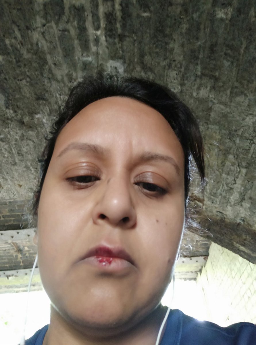 Think my running journey is over...
Didn't make it2 10k as ran past a man who whistled at me &amp; then stuck his foot out.
Couldn't dodge it fast enough so went flying.
Not sure I'll have the confidence to go out again 
Being a woman feels really hard sometimes... 😔😔 #running