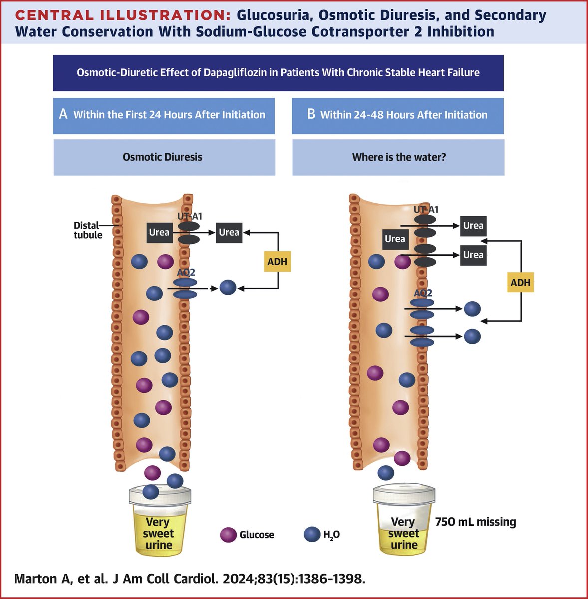 #SGLT2i release ⬆️ glucose into the urine, & thereby have the potential to pull ⬆️ fluid from the body via osmosis into the urine & decongest pts w/ heart disease New data, however, casts doubt on this presumed diuretic action of SGLT2i in pts w/ HF bit.ly/3xGuUH4 #JACC