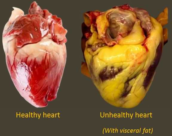 Excess belly fat can lead to

- Early heart failure
- Lower confidence
-  Certain cancers
- Type 2 diabetes

The easiest way to lose fat is to improve your diet.

Here are 5 quick, tasty, low calorie, and high protein meals you NEED to try: