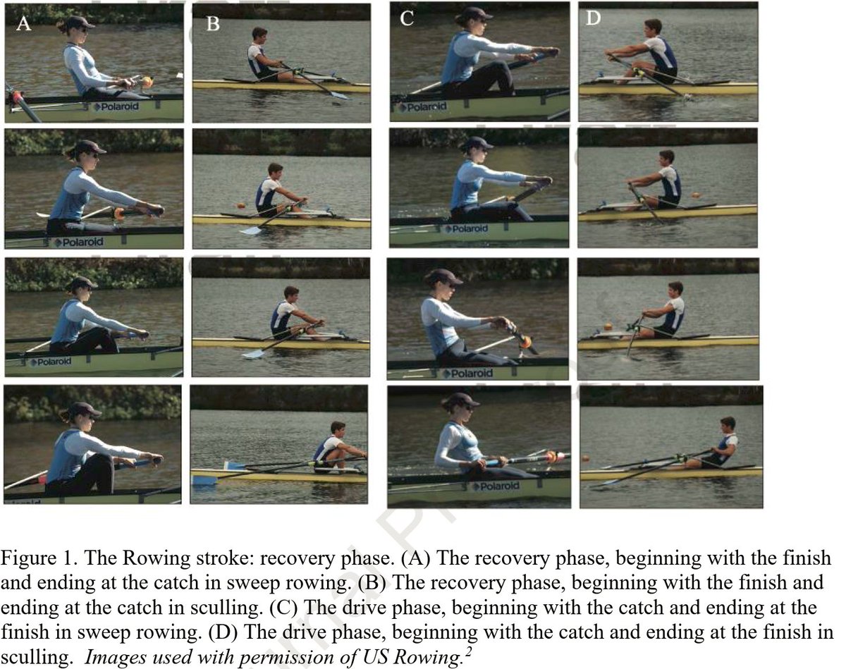 The rowing spine: A review of biomechanics, injury, and treatment

pubmed.ncbi.nlm.nih.gov/38608819/