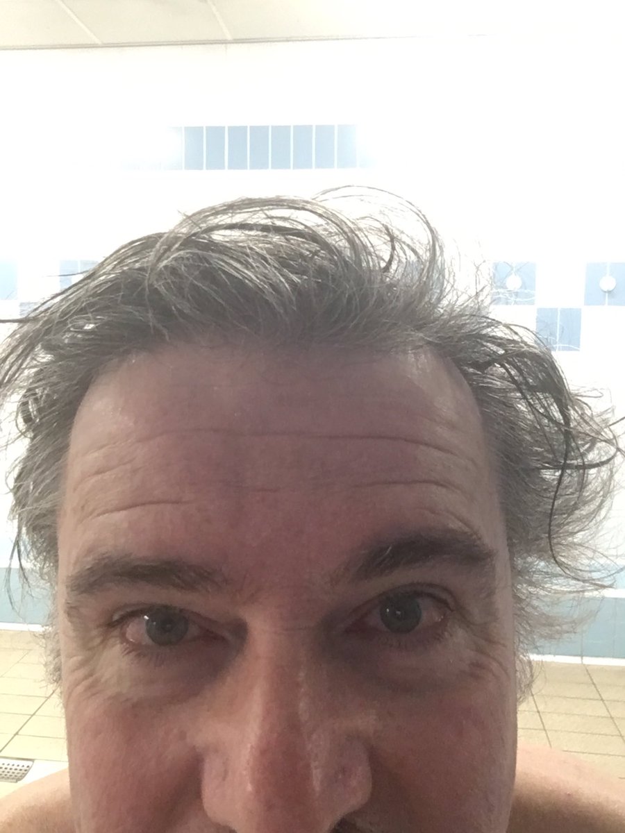 Getting back to my best 22 lengths in 20 mins , 42 in 50 & still able to play 3 & in AND a gam of volleyball within the hour! #roadtorecovery shoulder feels better Pope is STILL out injured yet mine was on flagstone not grass ! #swim