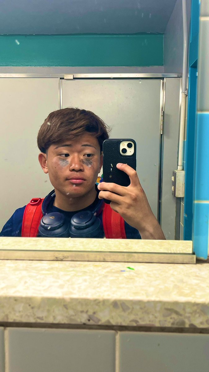 t_8olo's tweet photo. 生まれつき目が弱いからアイブラックはよくしますが、皆さんも俺が眩しすぎて、失明しないように目の下黒くしといてくださいね。
僕のチャームポイント見つけました。
#大菱形骨 https://t.co/VNmh66mDrB
