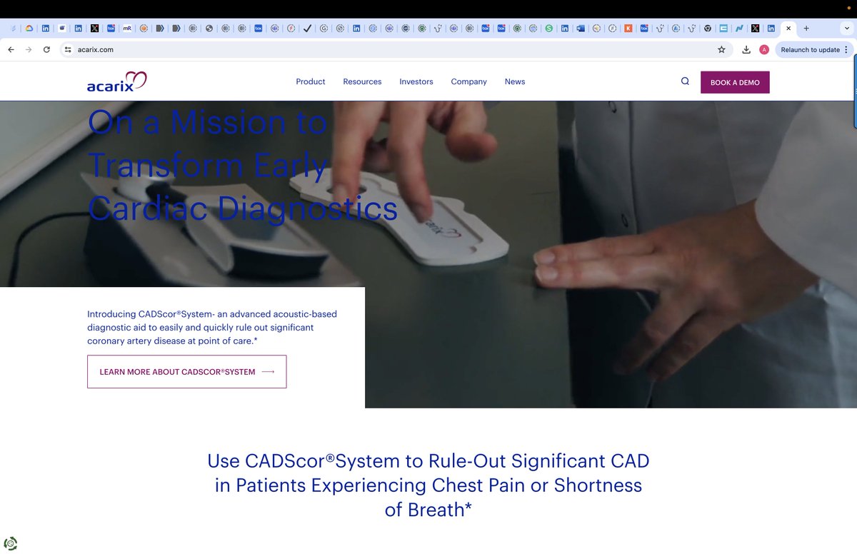 I rarely talk about my family on social media but making an exception here. A big shoutout to @UCDavisHealth team and #SurabhiAtreja for leading first US based study evaluating CADscore system to Rule-Out Significant CAD in ER view.news.eu.nasdaq.com/view?id=bb0d60…