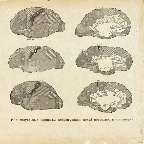 En 1930, el equipo de neurólogos afirmó que ciertas neuronas de la corteza cerebral de Lenin eran más numerosas y de mayor tamaño de lo normal.

Solo la llegada de los nazis al poder frenó nuevas investigaciones de Vogt, que aspiraba a comparar el cerebro con el de otras figuras