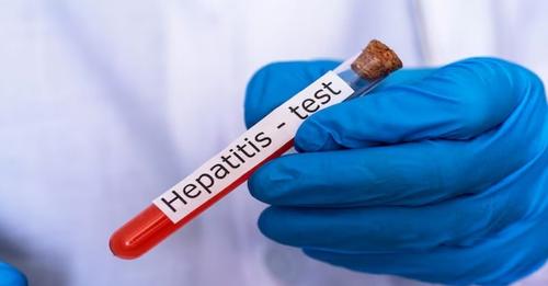 NEWS 📰 India among nations with highest hepatitis B/C: What are these infections, how to prevent them? 🗣️According to a WHO report released to coincide with the World Hepatitis Summit in Portugal, India has the 2nd highest cases of viral hepatitis. 🗞️ ow.ly/q51T50Rf86f