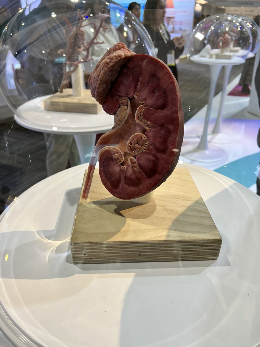 Tasha Jawa (@jawatasha) on Twitter photo Grateful to be in Buenos Aires at #ISNWCN presenting our work on neurological outcomes of patients undergoing #dialysis in the #ICU! Check out my virtual poster here: wcn24.theisn.org/user/form/view… Grateful to be in Buenos Aires at #ISNWCN presenting our work on neurological outcomes of patients undergoing #dialysis in the #ICU! Check out my virtual poster here: wcn24.theisn.org/user/form/view…