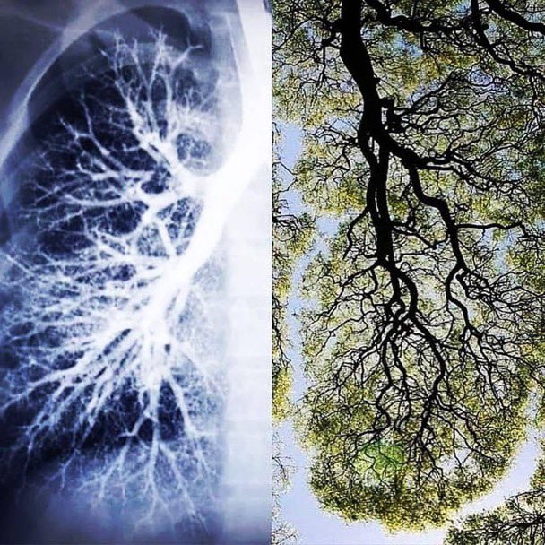 ninjasniperpon's tweet photo. A lung and a tree. We breathe in what the trees exhale and they breathe in what we breathe out. https://t.co/oRnMOjyTwx