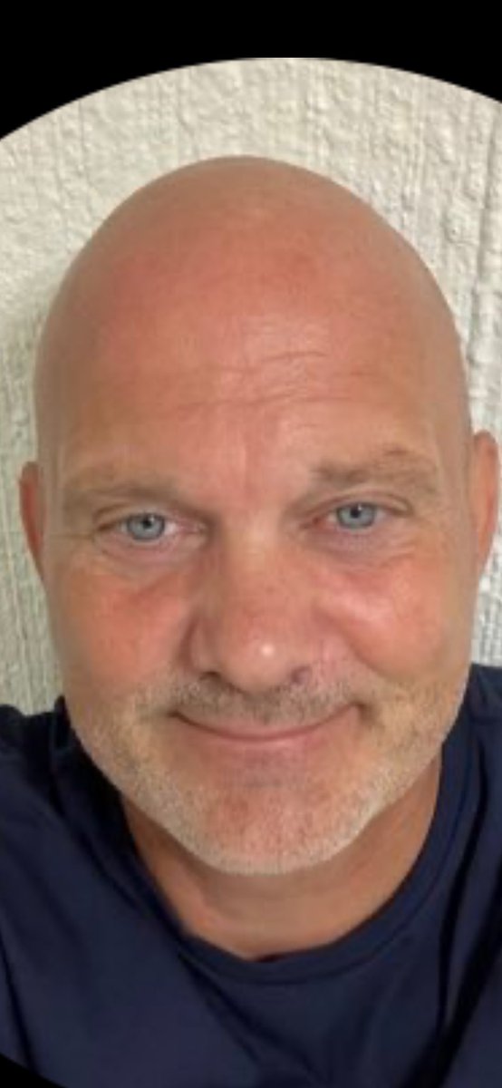 BIF_Kenned's tweet photo. @henjohansen1 @BrondbyIF Hvorfor tager du ikke til Alanya og får lavet en hår transplantation du har et vildt æggeformet hoved hvilket ikke er særlig pænt når man er skaldet https://t.co/RjwUPiARbQ