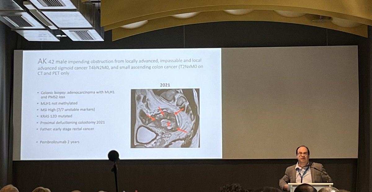 CANS (@chelwestcans) on Twitter photo Great presentation on managing complex #colorectalcancers, adverse prognostic factors predicting poor outcome and benefits of neoadjuvant options <a href="/colothrive/">Colorectal THRIVE</a> #THRIVEcolorectal by <a href="/ParisTekkis/">Paris Tekkis</a> <a href="/ChelwestFT/">Chelsea and Westminster Hospital</a> <a href="/OneWelbeckDige1/">OneWelbeck Digestive Health</a> <a href="/royalmarsdenNHS/">The Royal Marsden NHS Foundation Trust</a> Great presentation on managing complex #colorectalcancers, adverse prognostic factors predicting poor outcome and benefits of neoadjuvant options <a href="/colothrive/">Colorectal THRIVE</a> #THRIVEcolorectal by <a href="/ParisTekkis/">Paris Tekkis</a> <a href="/ChelwestFT/">Chelsea and Westminster Hospital</a> <a href="/OneWelbeckDige1/">OneWelbeck Digestive Health</a> <a href="/royalmarsdenNHS/">The Royal Marsden NHS Foundation Trust</a>