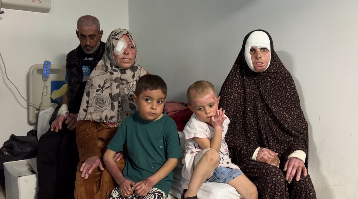 Seyma Garmud and her family members were injured and severely burned by Israeli missiles in Jabalia refugee camp. They were interviewed in Rafah, Gaza on April 7, 2024.